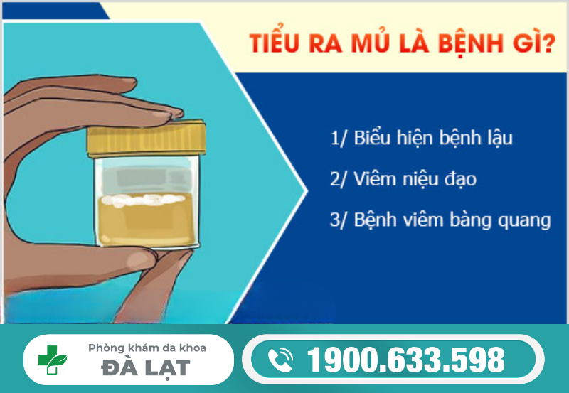 Hình ảnh minh họa